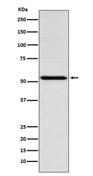 THRA Rabbit Monoclonal Antibody