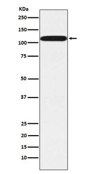 Pumilio 2 Rabbit Monoclonal Antibody