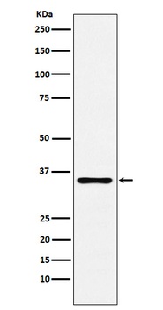 DCR2 Rabbit Monoclonal Antibody