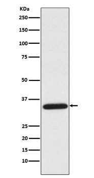 UNG Rabbit Monoclonal Antibody