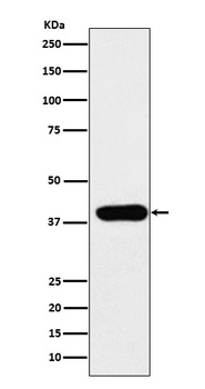 ADA Rabbit Monoclonal Antibody
