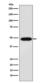 MAGE 1 Rabbit Monoclonal Antibody