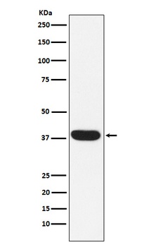 MYF5 Rabbit Monoclonal Antibody