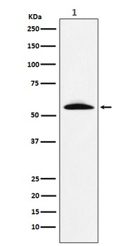 GGT1 Rabbit Monoclonal Antibody