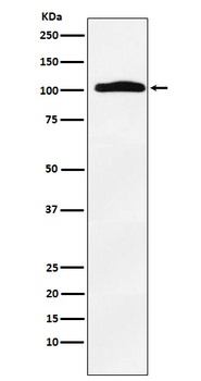 Thyroid Peroxidase Rabbit Monoclonal Antibody (Peroxidase)