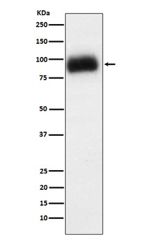 ADAM15 Rabbit Monoclonal Antibody