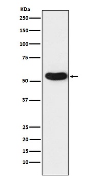 CHRNA5 Rabbit Monoclonal Antibody