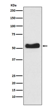 Glucokinase Rabbit Monoclonal Antibody