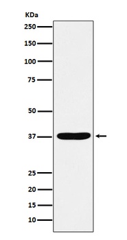 AKR1C1/AKR1C2 Rabbit Monoclonal Antibody