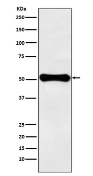 GLUD1 Rabbit Monoclonal Antibody