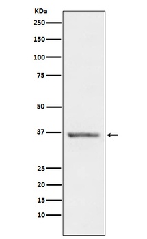 STC1 Rabbit Monoclonal Antibody