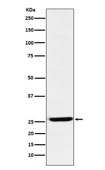 EBI3 Rabbit Monoclonal Antibody