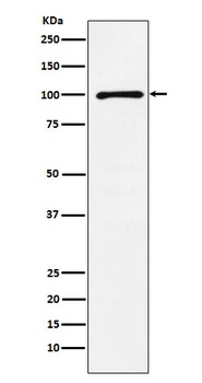 GRIK2 Rabbit Monoclonal Antibody