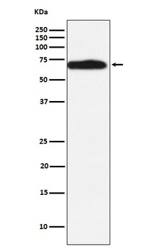 RYK Rabbit Monoclonal Antibody