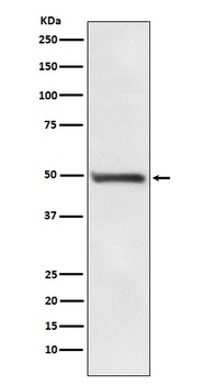 RAD52 Rabbit Monoclonal Antibody