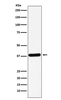CRKII Rabbit Monoclonal Antibody