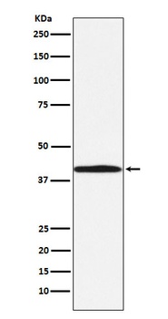 BGAT Rabbit Monoclonal Antibody