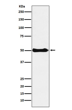 CSK Rabbit Monoclonal Antibody