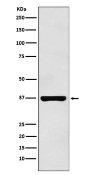 PIM2 Rabbit Monoclonal Antibody