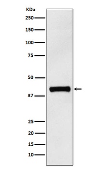 IL12 p40 Rabbit Monoclonal Antibody