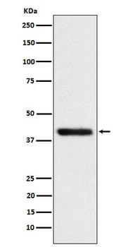 TMOD2 Rabbit Monoclonal Antibody