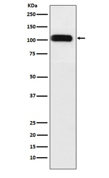 SERCA1 ATPase Rabbit Monoclonal Antibody