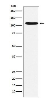 HIRA Rabbit Monoclonal Antibody