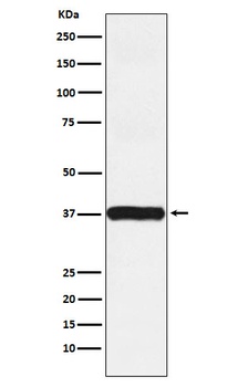 Arp2 Rabbit Monoclonal Antibody