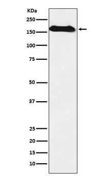 NAIP Rabbit Monoclonal Antibody