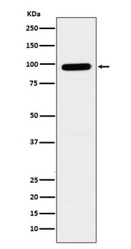 GLB1 Rabbit Monoclonal Antibody