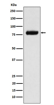 PLAP Rabbit Monoclonal Antibody
