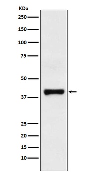 GOT2 Rabbit Monoclonal Antibody