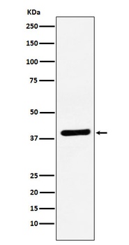 VEGFD Rabbit Monoclonal Antibody