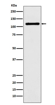 DPYD Rabbit Monoclonal Antibody