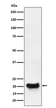 DCTN5 Rabbit Monoclonal Antibody