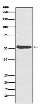 ACVR1 Rabbit Monoclonal Antibody