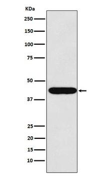 LHX2 Rabbit Monoclonal Antibody