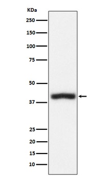 CD1c Rabbit Monoclonal Antibody