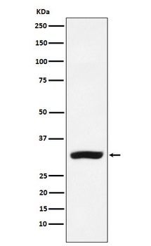 CBR1 Rabbit Monoclonal Antibody