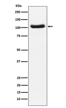 PDE2A Rabbit Monoclonal Antibody