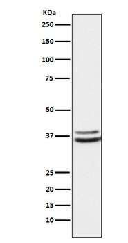 PIM2 Rabbit Monoclonal Antibody