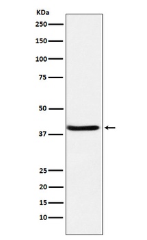 SerpinB3 Rabbit Monoclonal Antibody