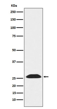 UCHL3 Rabbit Monoclonal Antibody