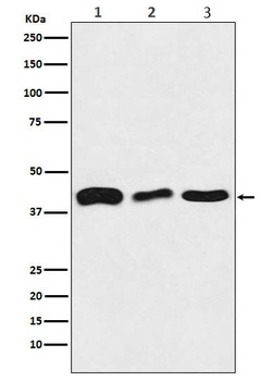 TDP43 Rabbit Monoclonal Antibody