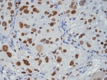 TDP43 Rabbit Monoclonal Antibody