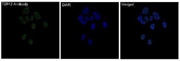 TDP43 Rabbit Monoclonal Antibody
