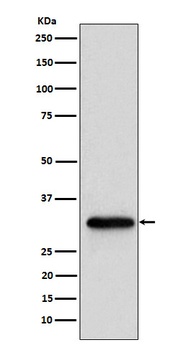 NUDT5 Rabbit Monoclonal Antibody