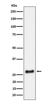 SNRPA1 Rabbit Monoclonal Antibody