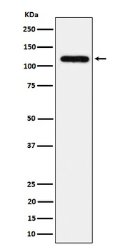 UBE4A Rabbit Monoclonal Antibody