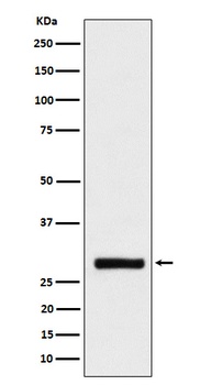 BRMS1 Rabbit Monoclonal Antibody